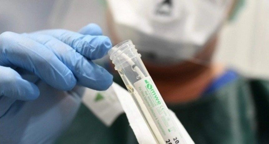 LA MUESTRA PARA EL ANALISIS FUE TRASLADADA A AZUL