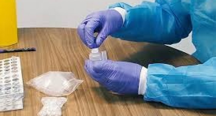 LLEGO EL RESULTADO: DIO NEGATIVO