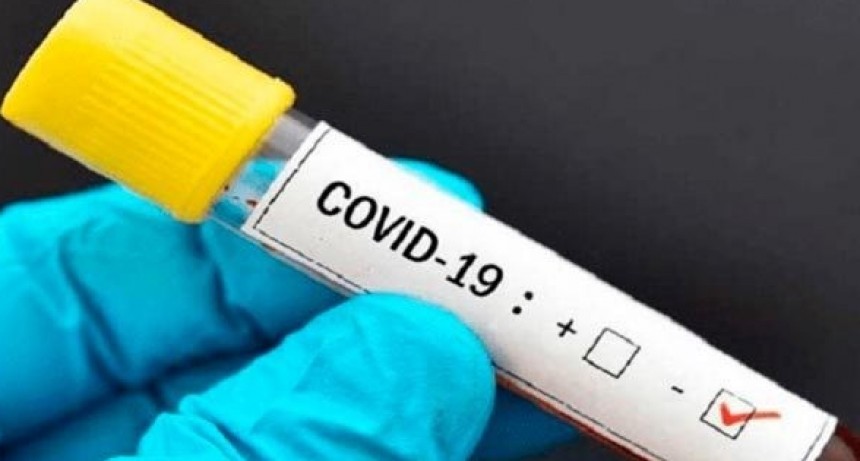 ¡ULTIMO MOMENTO!: MUESTRA NEGATIVA. TRES LOMAS SIGUE LIBRE DE COVID 19