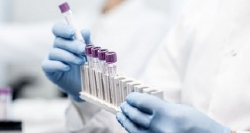 Científicos rusos crearon un test de cáncer de próstata parecido a la prueba de embarazo