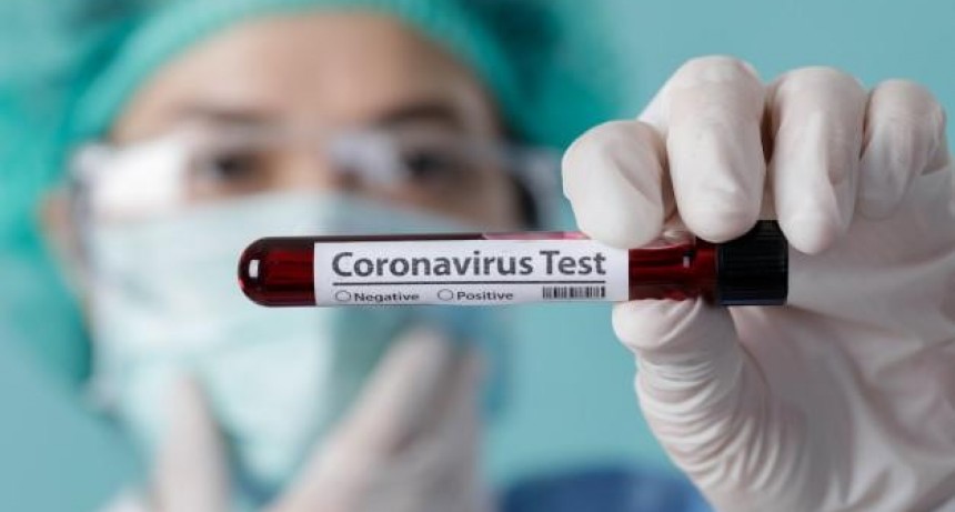 LAS MUESTRAS RESULTARON NEGATIVAS