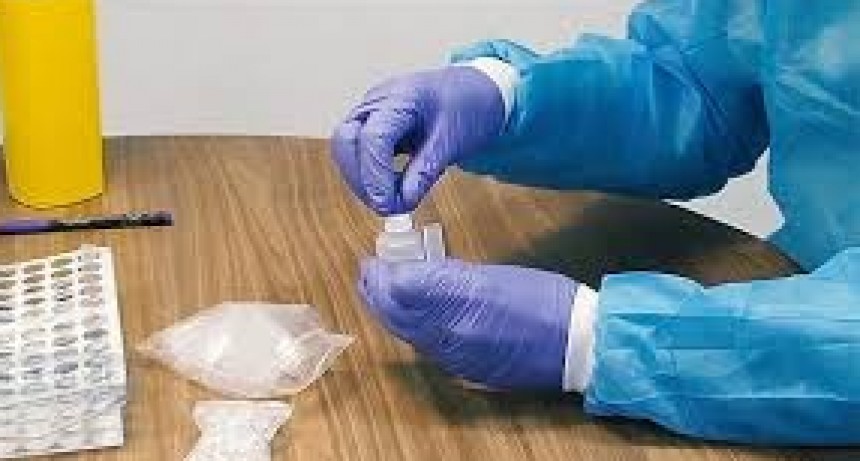 DIERON A CONOCER EL RESULTADO DEL HISOPADO DEL CASO SOSPECHOSO: NEGATIVO