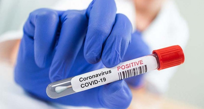 EL VIRUS LLEGO A LA ZONA: HABRIA DOS CASOS CONFIRMADOS EN PELLEGRINI