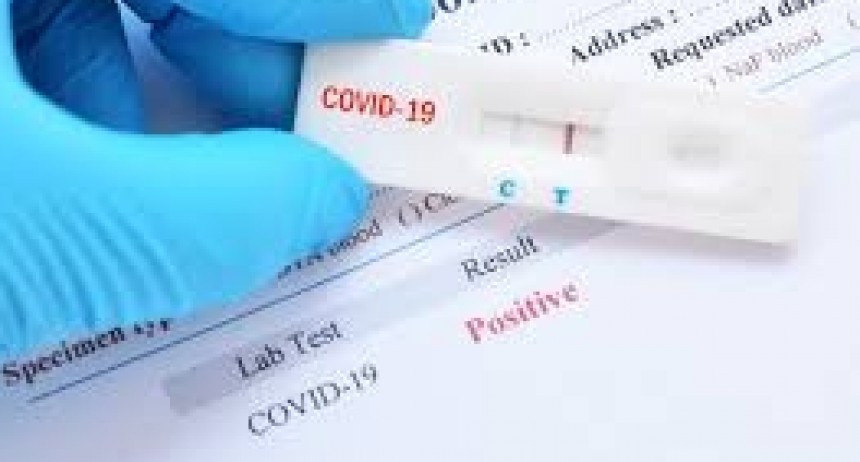 UN RESULTADO POSITIVO EN UN TEST RAPIDO ACTIVA LOS PROTOCOLOS PERO NO SIGNIFICA QUE LA PERSONA ESTE INFECTADA