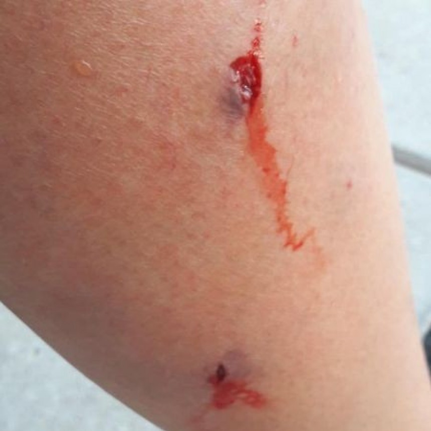 UNA CICLISTA FUE MORDIDA POR DOS PERROS